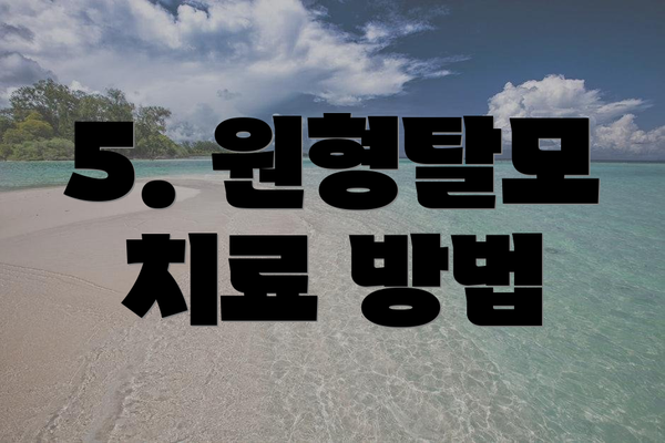 5. 원형탈모 치료 방법